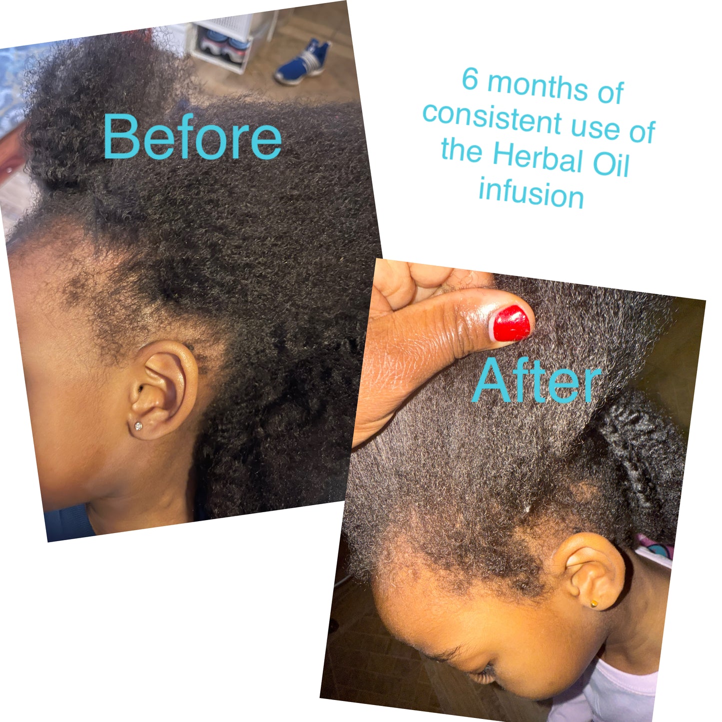 Herbal Hair Growth Infusion