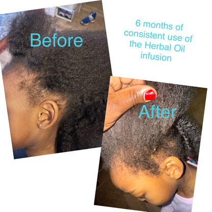 Herbal Hair Growth Infusion